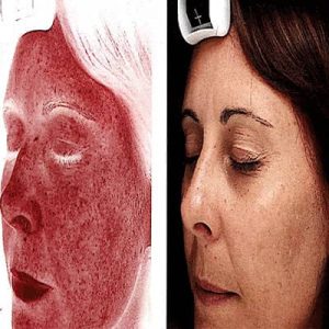 کرم ضد آفتاب و ضد لک بی رنگ لاسانته
